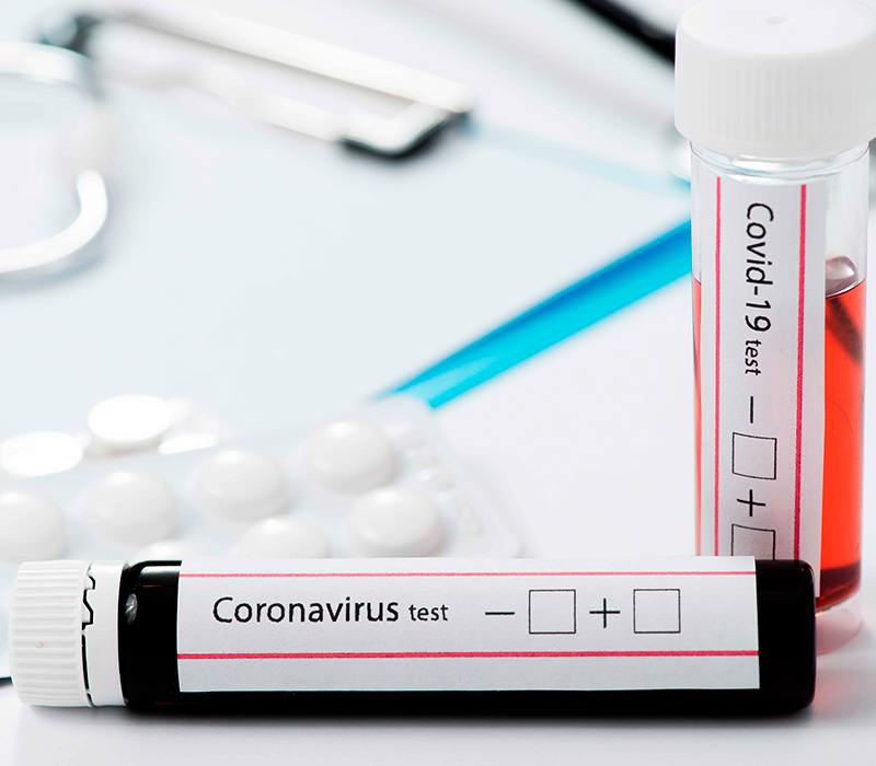 Anvisa autoriza farmácias e drogarias a realizarem testes de Covid-19